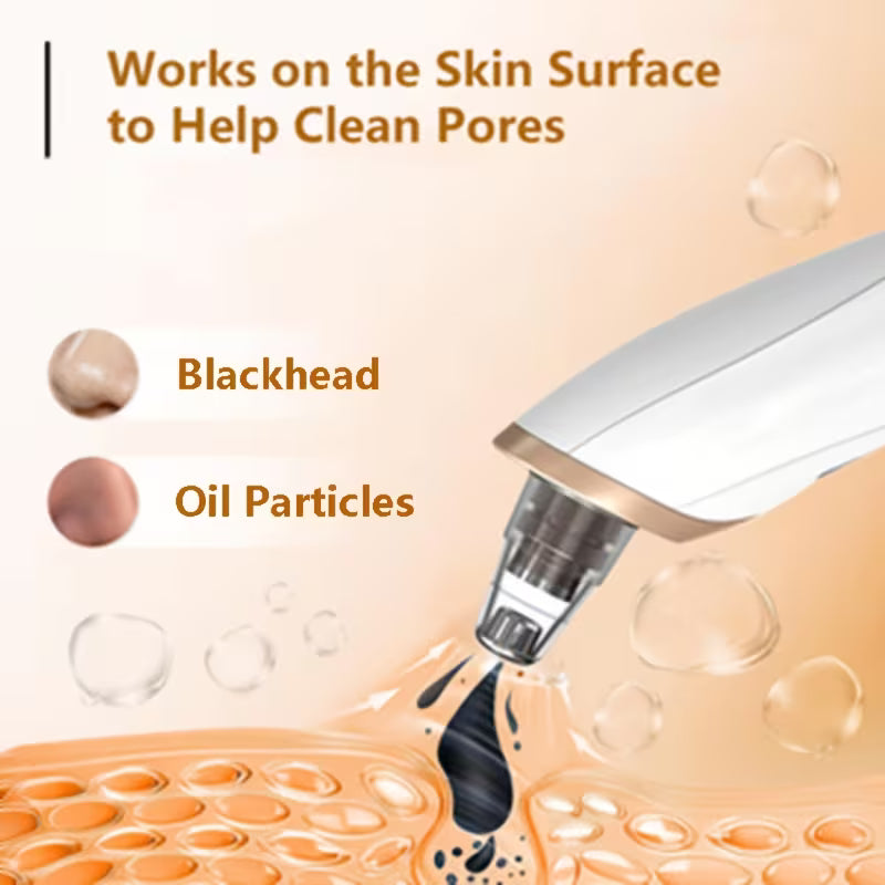 5-in-1 Blackhead Remover ✨50% OFF SALEE⚡