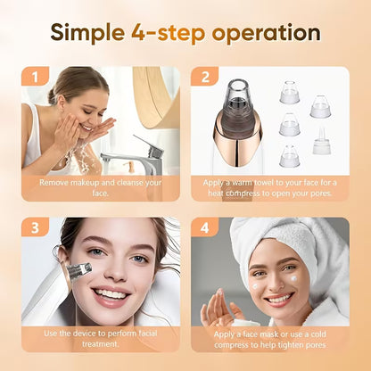 5-in-1 Blackhead Remover ✨50% OFF SALEE⚡